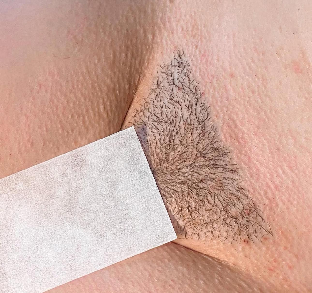 unnamed image